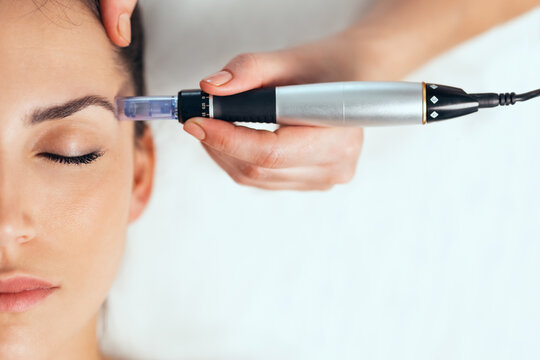 Gratis Intro: Microneedling voor Salons (online)